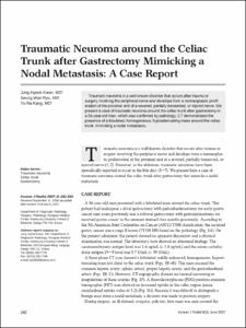 Traumatic Neuroma around the Celiac Trunk after Gastrectomy Mimicking a Nodal Metastasis: A Case Report