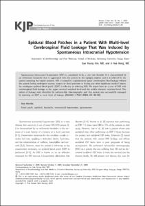 Epidural Blood Patches in a Patient With Multi-level Cerebrospinal Fluid Leakage That Was Induced by Spontaneous Intracranial Hypotension