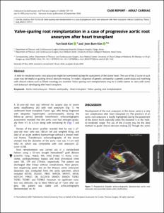Valve-sparing root reimplantation in a case of progressive aortic root aneurysm after heart transplant