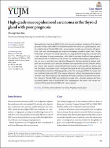 High-grade mucoepidermoid carcinoma in the thyroid gland with poor prognosis