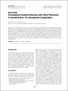 Contralateral Cerebral Infarction after Stent Placement in Carotid Artery : An Unexpected Complication