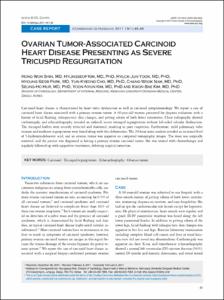 Ovarian Tumor-Associated Carcinoid Heart Disease Presenting as Severe Tricuspid Regurgitation