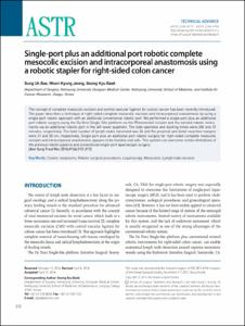 Single-port plus an additional port robotic complete mesocolic excision and intracorporeal anastomosis using a robotic stapler for right-sided colon cancer