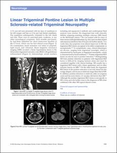 Linear Trigeminal Pontine Lesion in Multiple Sclerosis-related Trigeminal Neuropathy