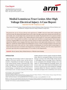 Medial lemniscus tract lesion after high voltage electrical injury: A case report