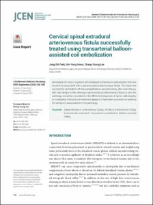 Cervical spinal extradural arteriovenous fistula successfully treated using transarterial balloon-assisted coil embolization