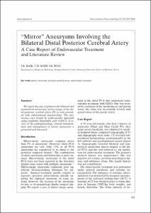 “Mirror” Aneurysms Involving the
Bilateral Distal Posterior Cerebral Artery
A Case Report of Endovascular Treatment
and Literature Review