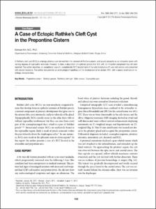 A Case of Ectopic Rathke’s Cleft Cyst in the Prepontine Cistern