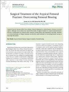 Surgical Treatment of the Atypical Femoral Fracture: Overcoming Femoral Bowing