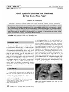 Horner Syndrome associated with a Herniated
Cervical Disc: A Case Report