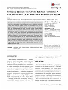 Refractory Spontaneous Chronic Subdural Hematoma: A Rare Presentation of an Intracranial Arteriovenous Fistula