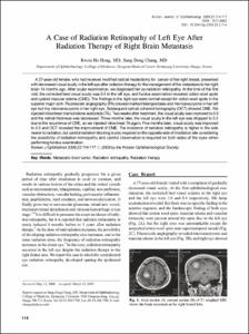 A Case of Radiation Retinopathy of Left Eye After Radiation Therapy of Right Brain Metastasis