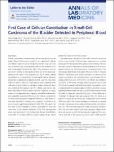First Case of Cellular Cannibalism in Small-Cell Carcinoma of the Bladder Detected in Peripheral Blood