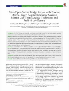 Mini-Open Suture Bridge Repair with Porcine Dermal Patch Augmentation for Massive
Rotator Cuff Tear: Surgical Technique and Preliminary Results