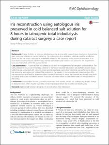 Iris reconstruction using autologous iris preserved in cold balanced salt solution for 8 hours in iatrogenic total iridodialysis during cataract surgery: a case report.