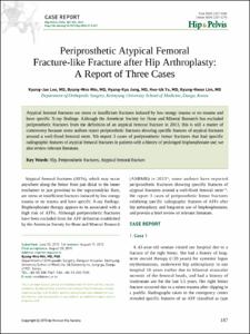 Periprosthetic Atypical Femoral Fracture-like Fracture after Hip Arthroplasty: A Report of Three Cases