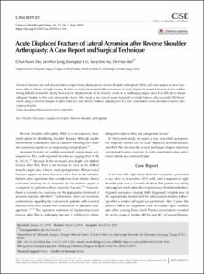 Acute Displaced Fracture of Lateral Acromion after Reverse Shoulder Arthroplasty:  A Case Report and Surgical Technique