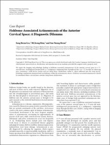 Fishbone-Associated Actinomycosis of the Anterior Cervical Space: A Diagnostic Dilemma
