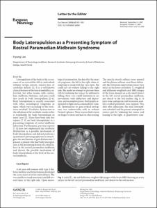 Body Lateropulsion as a Presenting Symptom of
Rostral Paramedian Midbrain Syndrome