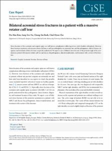 Bilateral acromial stress fractures in a patient with a massive rotator cuff tear
