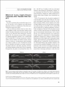 Bilateral Acute Angle-Closure Glaucoma after Macular Hole Surgery