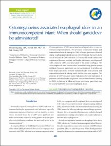 Cytomegalovirus-associated esophageal ulcer in an immunocompetent infant: When should ganciclovir be administered?