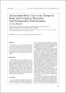 Aneurysmal Bone Cyst in the Temporal
Bone and Complete Resection
with Preoperative Embolization
A Case Report