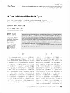 A Case of Bilateral Nasolabial Cysts