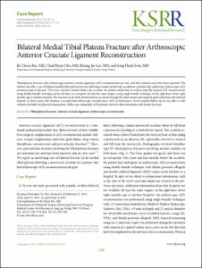Bilateral Medial Tibial Plateau Fracture after Arthroscopic Anterior Cruciate Ligament Reconstruction