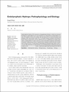Endolymphatic Hydrops: Pathophysiology and Etiology