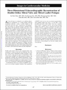 Three-Dimensional Echocardiographic Reconstruction of Double-Orifice Mitral Valve and Mitral Leaflet Prolapse