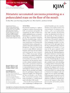 Metastatic sarcomatoid carcinoma presenting as a
pedunculated mass on the floor of the mouth