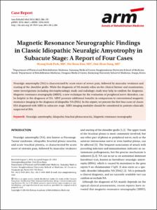 Magnetic Resonance Neurographic Findings in Classic Idiopathic Neuralgic Amyotrophy in Subacute Stage: A Report of Four Cases