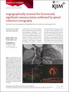 Angiographically minimal but functionally significant coronary lesion confirmed by optical coherence tomography