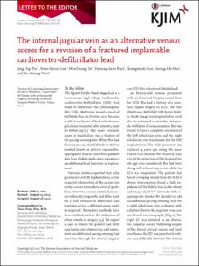 The internal jugular vein as an alternative venous access for a revision of a fractured implantable cardioverter-defibrillator lead
