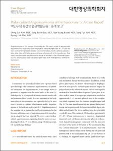 Pedunculated Angioleiomyoma of the Nasopharynx: A Case Report