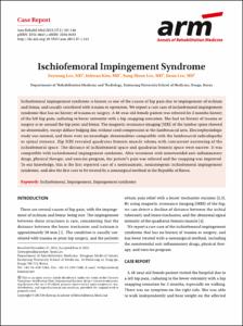 Ischiofemoral Impingement Syndrome