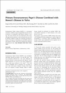 Primary Extramammary Paget's Disease Combined with Bowen's Disease in Vulva