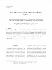 A Case of Pneumatosis Intestinalis in Ph+ Acute Lymphoblastic Leukemia