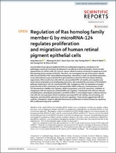 Regulation of Ras homolog family member G by microRNA-124 regulates proliferation and migration of human retinal pigment epithelial cells