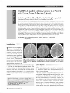 Ictal SPECT-guided Epilepsy Surgery in a Patient with Forme Fruste Tuberous Sclerosis