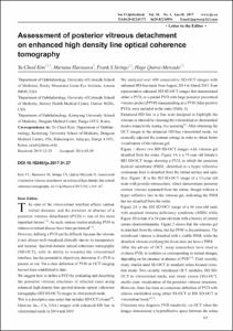 Assessment of posterior vitreous detachment on enhanced high density line optical coherence tomography